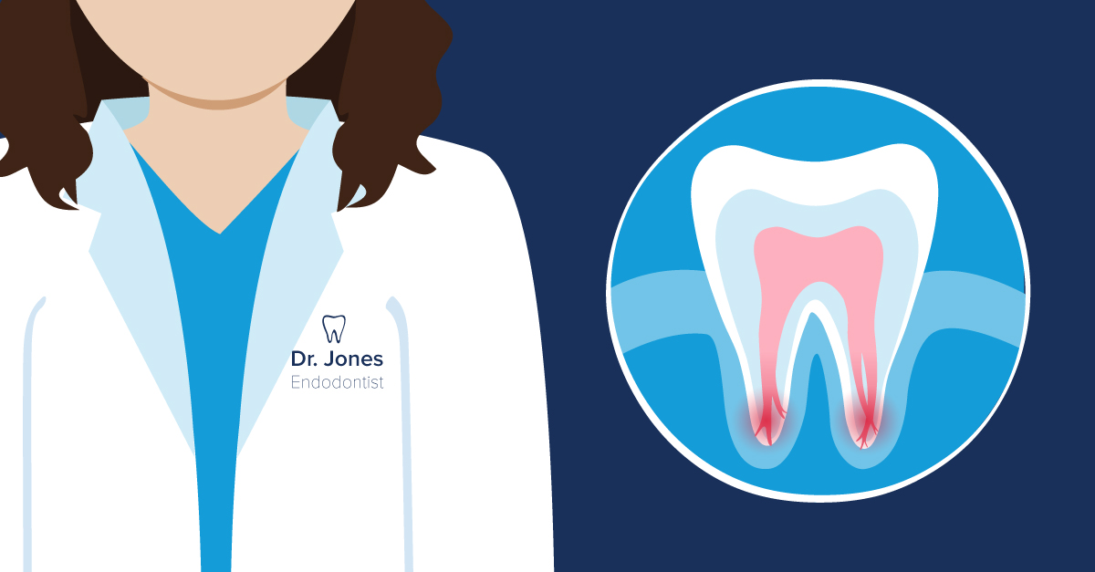 When Should You Seek a Root Canal Specialist GentleWave Procedure